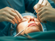 Facelift Plastic Surgery