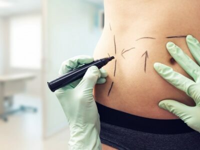 Body Contouring Procedures You Should Know About Body Contouring