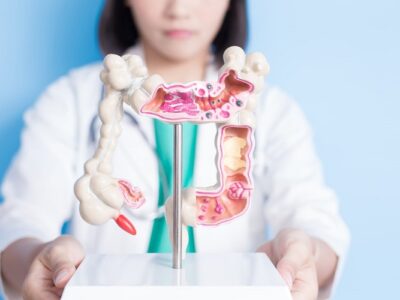 Colorectal Cancer