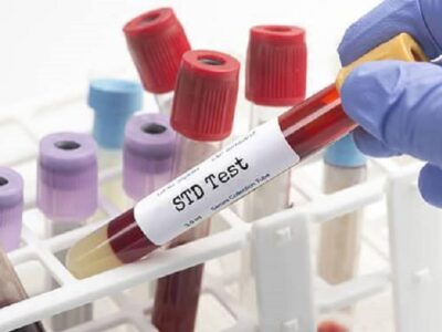 STD Testing and Its Benefits STD Testing