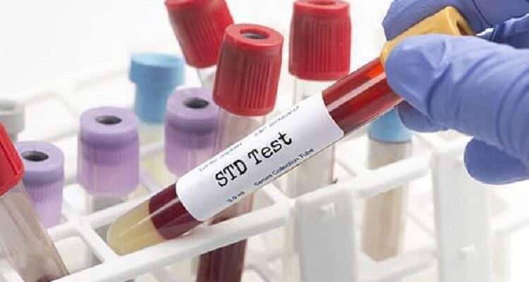 STD Testing