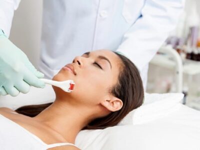 Everything You Should Know About Microneedling Microneedling