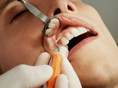 Cosmetic Dental