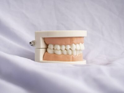 Stain Teeth