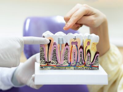 Orthodontic Options