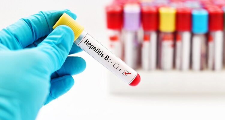 Hepatitis B